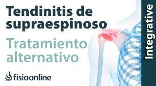 Tratamiento de la tendinitis de hombro o supraespinoso izquierda