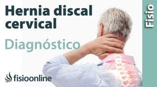 Cómo saber si tienes una hernia discal cervical