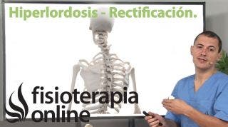 Hiperlordosis & Rectificación --- Curvas son Dinámicas & Rectas son Estáticas