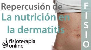 Importancia de la nutrición en el desarrollo en la dermatitis atópica
