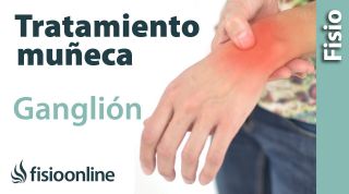 Tratamiento del ganglión de muñeca o muñeca abierta.