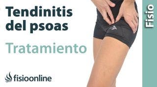 Tendinitis del psoas o psoitis. Tratamiento con ejercicios, auto masajes y estiramientos