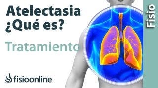 Atelectasia  Causas, síntomas y tratamiento desde la visión de la fisioterapia respiratoria