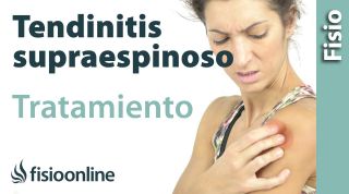 Tendinitis del supraespinoso. Tratamiento con ejercicios auto-masajes y estiramientos.
