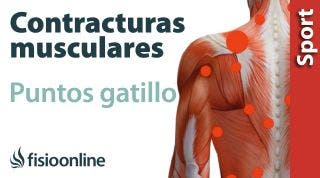 3 cosas que debes saber sobre la contracturas musculares y puntos gatillo