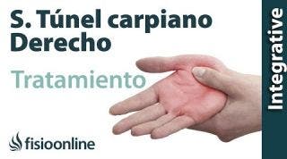 Tratamiento del síndrome de túnel carpiano derecho