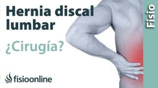 hernia discal lumbar: cuándo optar por la cirugía u operación quirúrgica