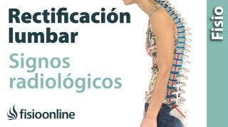 Rectificación lumbar. Signos radiológicos.