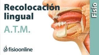 Ejercicio de reposicionamiento o recolocación lingual.