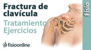 FRACTURA de CLAVÍCULA. Rehabilitación, ejercicios y tiempo de RECUPERACIÓN