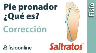 Pie Pronado o pronador. Qué es, causas y corrección