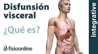 ¿Qué es una disfunción visceral?