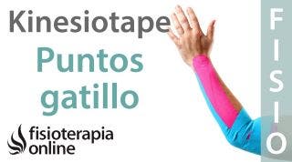 12 Kinesiotape en puntos gatillo