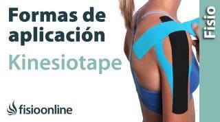 2 Formas de aplicación del Kinesiotaping