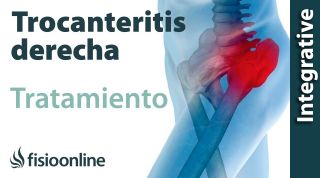 Tratamiento de la trocanteritis derecho