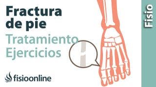 Rehabilitacion de fracturas del pie con ejercicios, auto masajes y estiramientos