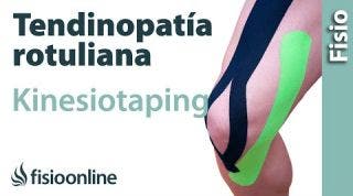 15 Kinesiostaping en la tendinopatia rotuliana