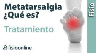 Metatalsargia. Tratamiento mediante ejercicios, auto masajes y estiramientos