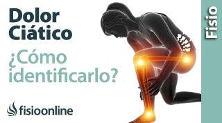 Cómo saber si tienes una CIÁTICA o dolor del nervio ciático