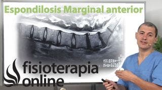 Espondilosis marginal anterior.¿Qué es?