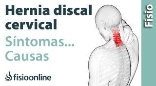 ¿Qué es la hernia discal cervical y cuáles son sus causas y síntomas?
