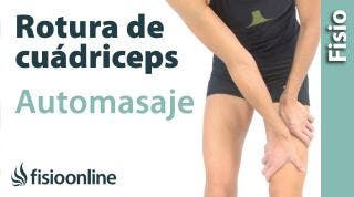 3.Auto-masaje para las roturas de fibras del recto anterior del cuádriceps.