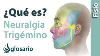 NEURALGIA DEL TRIGÉMINO | ¿Qué es?