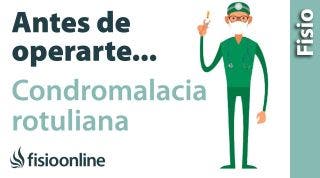 5 Cosas que debes de saber si vas a operarte de CONDROMALACIA ROTULIANA o desgaste de rótula