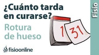 Cuánto tarda en curarse una fractura o ROTURA DE HUESO