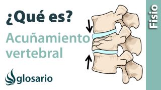 ACUÑAMIENTO VERTEBRAL | ¿Qué es?