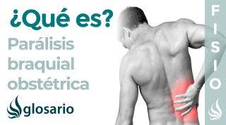 PARÁLISIS BRAQUIAL OBSTÉTRICA | Qué es, qué estructuras afecta, síntomas, causas y tratamiento
