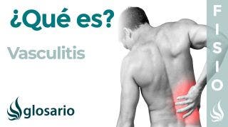 VASCULITIS | Qué es, qué estructuras afecta, síntomas, signos clínicos, causas y tratamiento