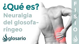 NEURALGIA del GLOSOFARÍNGEO | Qué es, síntomas, causas y tratamiento fisioterapéutico