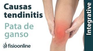 Causas de la tendinitis de la pata de ganso según la medicina natural