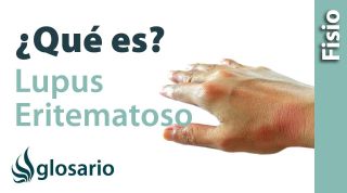 LUPUS ERITEMATOSO | ¿Qué es?
