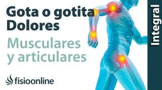 Gota, gotita o pseudogota  Dolores articulares y musculares 1 PGM