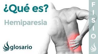 HEMIPARESIA | Qué es,  síntomas, signos clínicos, causas y tratamiento fisioterapéutico