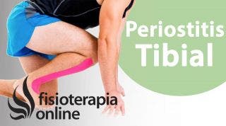 23 Kinesiotaping en la perostitis tibial