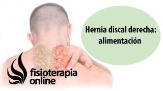 Hernia discal cervical derecha. Alimentación, nutrición y modificaciones en la dieta.