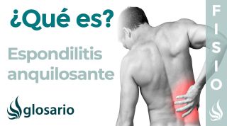 ESPONDILITIS ANQUILOSANTE | Qué es, qué estructuras afecta, síntomas, signos, causas y tratamiento