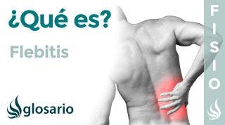 FLEBITIS | Qué es, qué afecta, síntomas, signos clínicos, causas y tratamiento fisioterapéutico