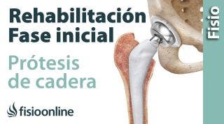 Rehabilitación de Prótesis de Cadera - Primera Fase