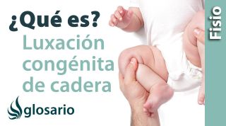 LUXACIÓN CONGÉNITA DE CADERA | ¿Qué es?