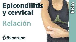 Epicondilitis y su relación con la zona cervical o vértebras cervicales