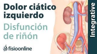 Ciática o ciatalgia izquierda por disfunción de riñón. Plantas medicinales y remedios naturales.