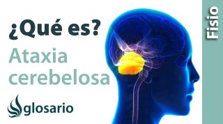 ATAXIA CEREBELOSA | ¿Qué es?