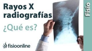 RX o radiografía, que es y cómo funciona