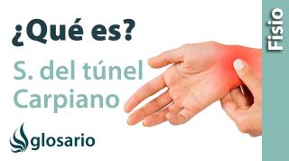 SÍNDROME DEL TÚNEL CARPIANO | ¿Qué es?