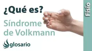 SÍNDROME DE VOLKMANN | ¿Qué es?