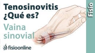 Vaina sinovial y tenosinovitis. ¿Que es?